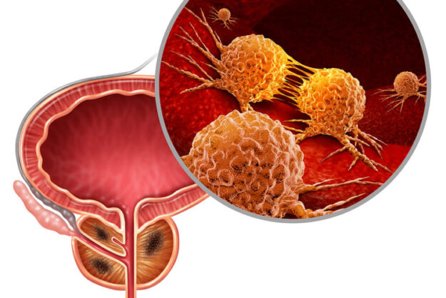 cancer_management-750×500